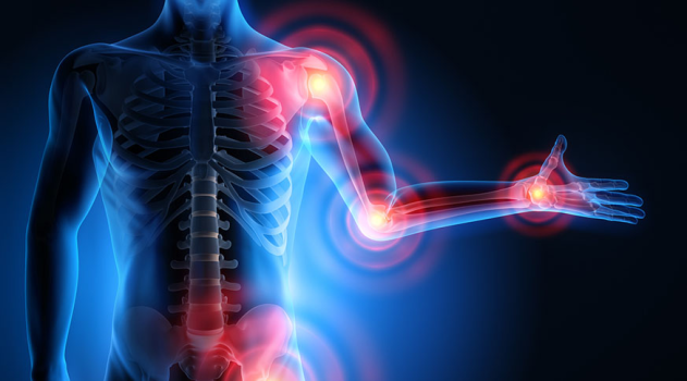 Rehabilitation of damage caused by "Achilles tendinitis"